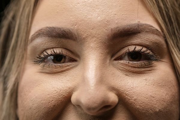 Cắt mí hay nhấn mí: khác nhau ở đâu và phương pháp nào hợp với bạn?