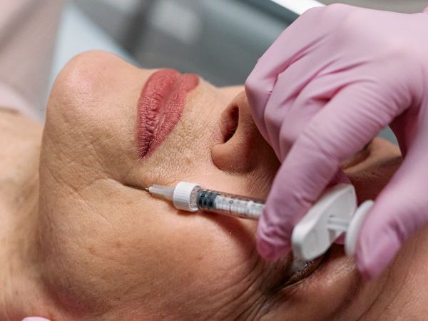 Botox thon gọn hàm