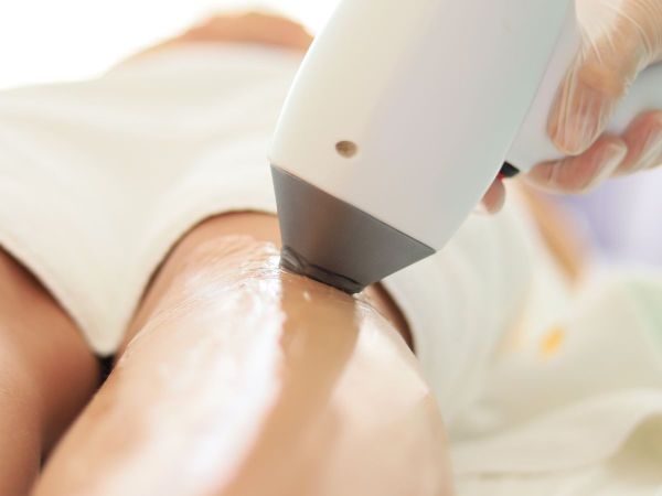 Triệt lông Diode Laser
