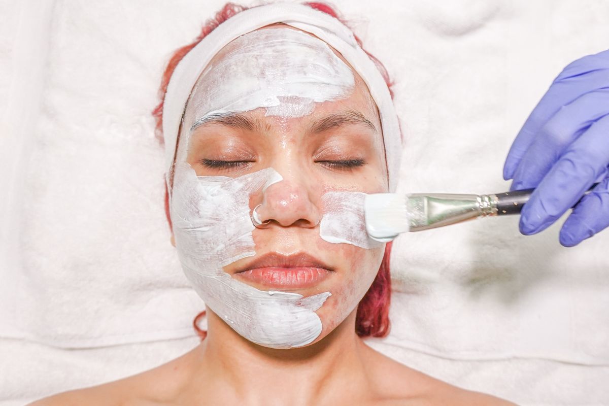 Phục hồi da sau laser, peel: 7 ngày đầu quyết định kết quả