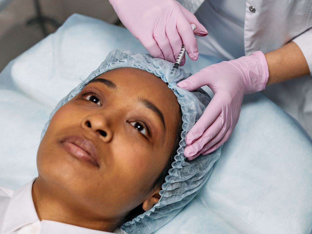 Xoá nhăn Botox vùng mắt – trán